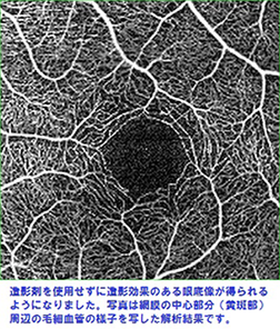 OCT（3次元光干渉断層計）